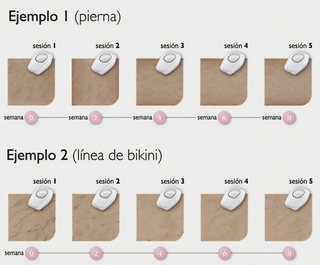 Depiladora Láser IPL — Resultados Profesionales en Casa