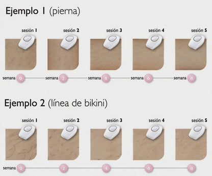 Depiladora Láser IPL — Resultados Profesionales en Casa